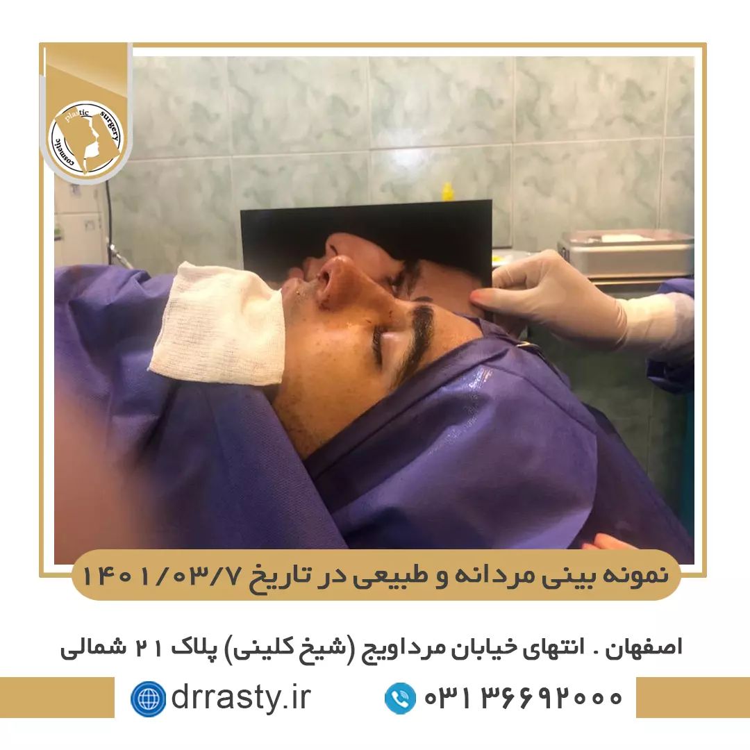 نمونه بینی مردانه و طبیعی