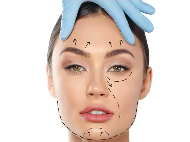 لیفت صورت بانخ مایع