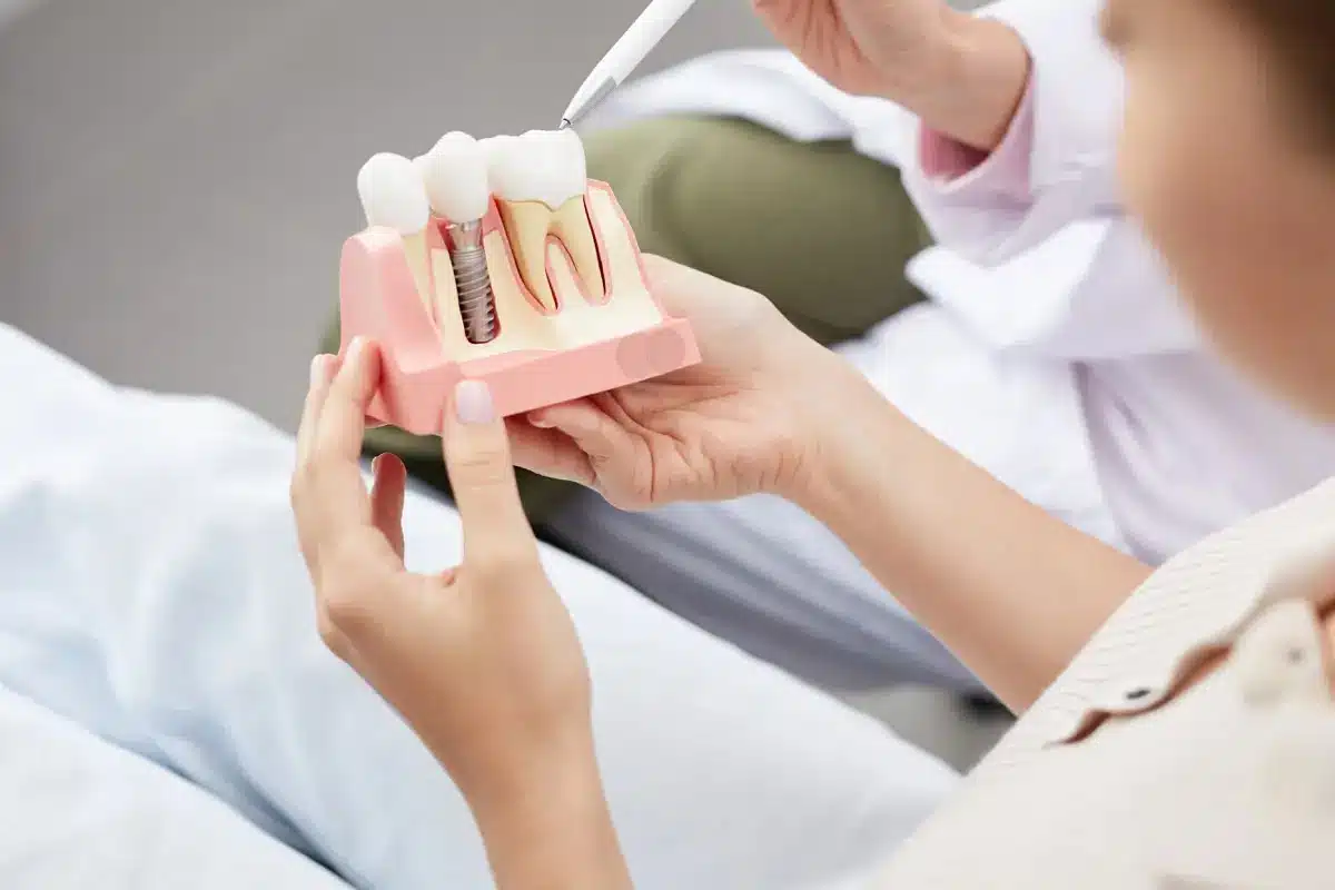 مشاوره و معاینه ایمپلنت