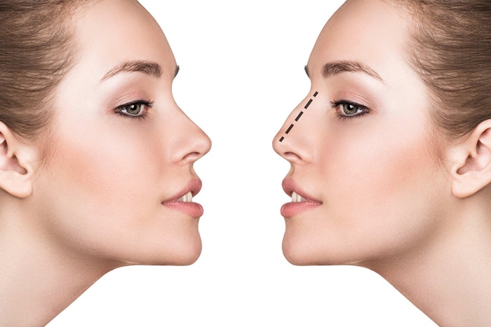 مدلینگ بینی