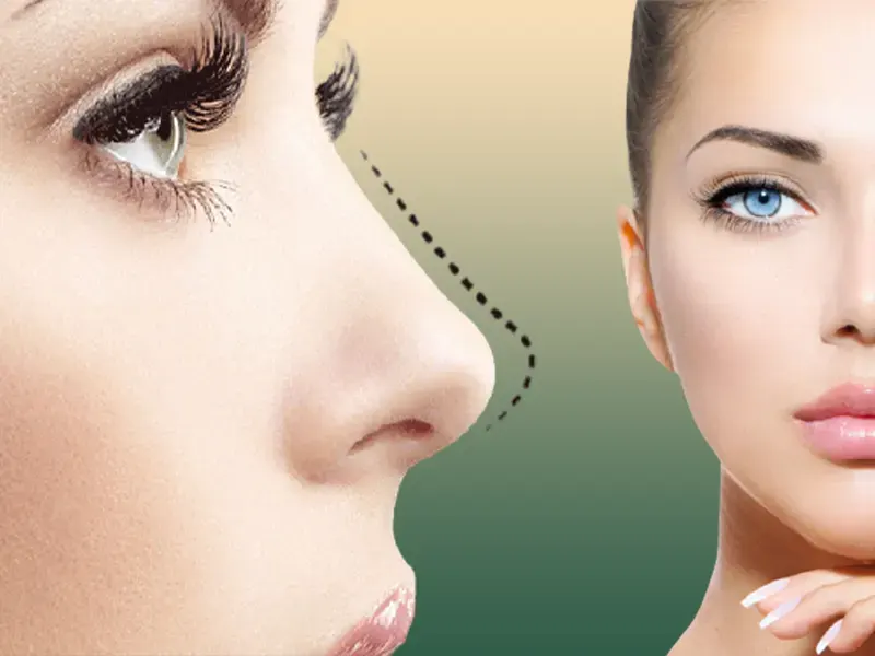 جراحی بینی ترمیمی