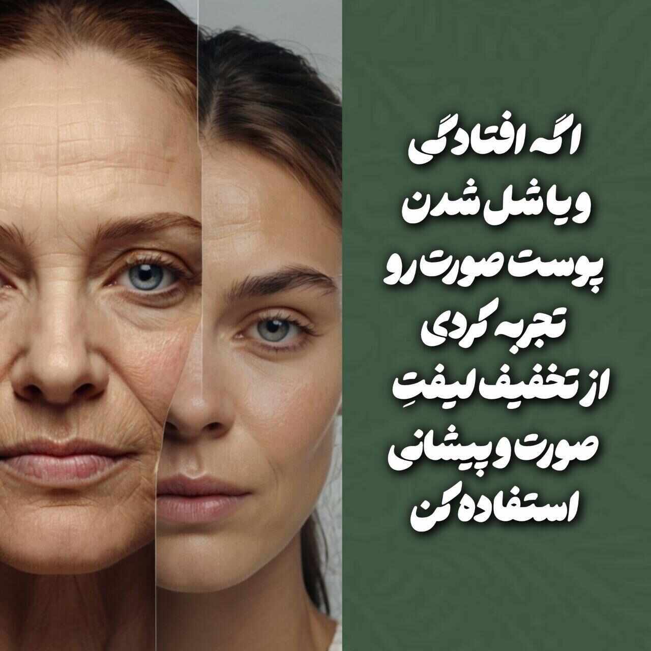 لیفت صورت و پیشانی با نخ در جشنواره یلدایی «پوست اناری» دکتر سید مجید حسینی