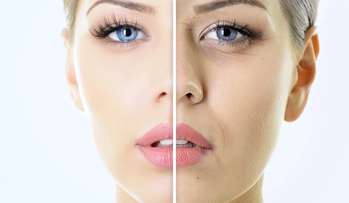 مزو جوان کننده