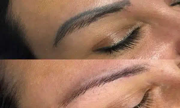 ریمو تتو ابرو بالیزر