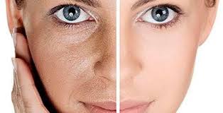 مزو روشن کننده کل صورت